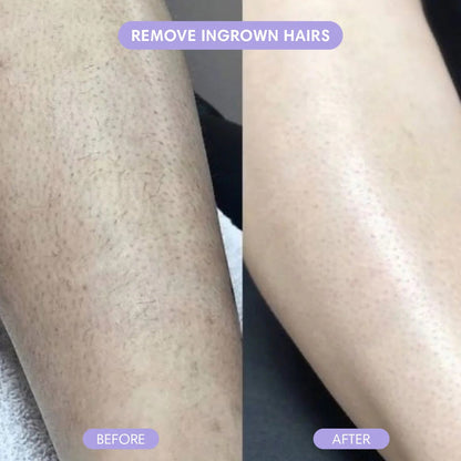 Wholly Bare - Hair Removal Pain-Free Hair Removal Mousse 50%OFF LAST DAY