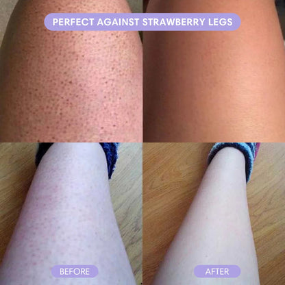 Wholly Bare - Hair Removal Pain-Free Hair Removal Mousse 50%OFF LAST DAY